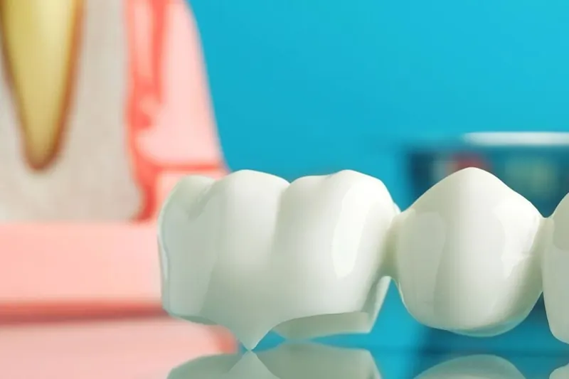 A model of a white ceramic bridge of crowns resting on glass