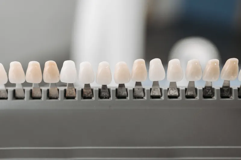 A row of tooth-coloured shade samples, from bright white to warm ivory